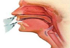 مهمترین علامت «سینوزیت»